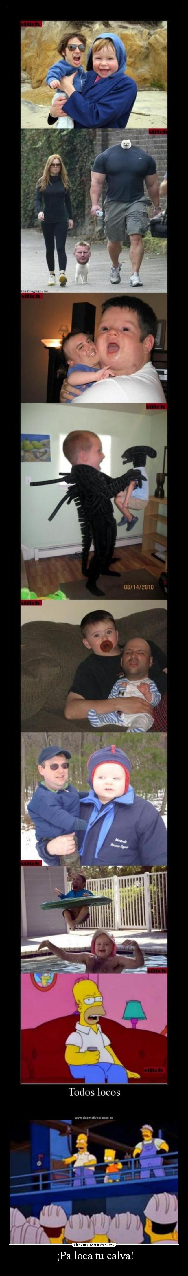 ¡Pa loca tu calva! - 