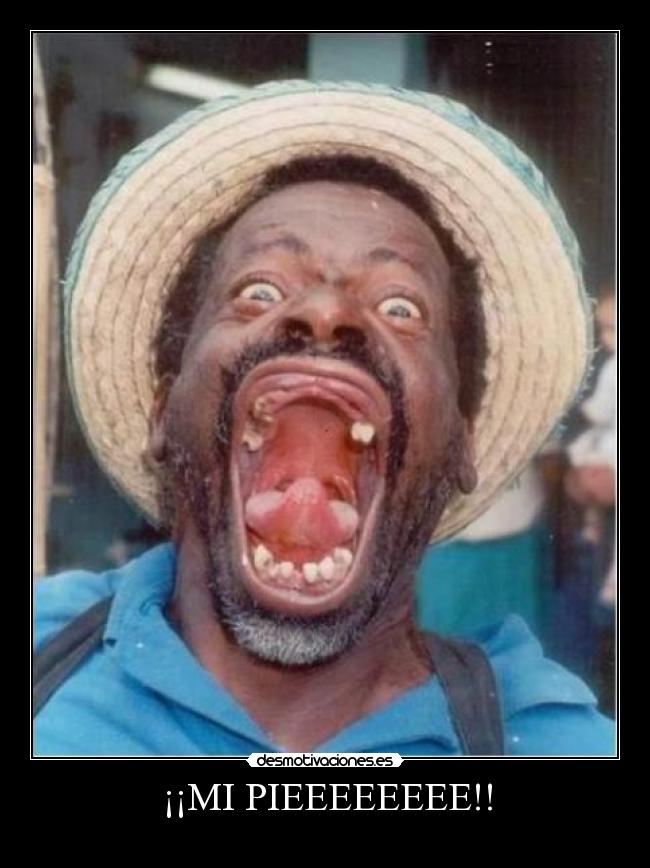 ¡¡MI PIEEEEEEEE!! - 