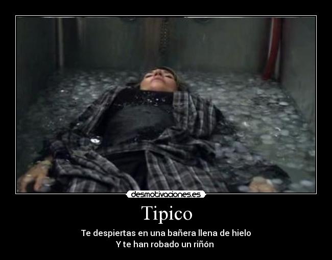 Tipico - Te despiertas en una bañera llena de hielo
Y te han robado un riñón