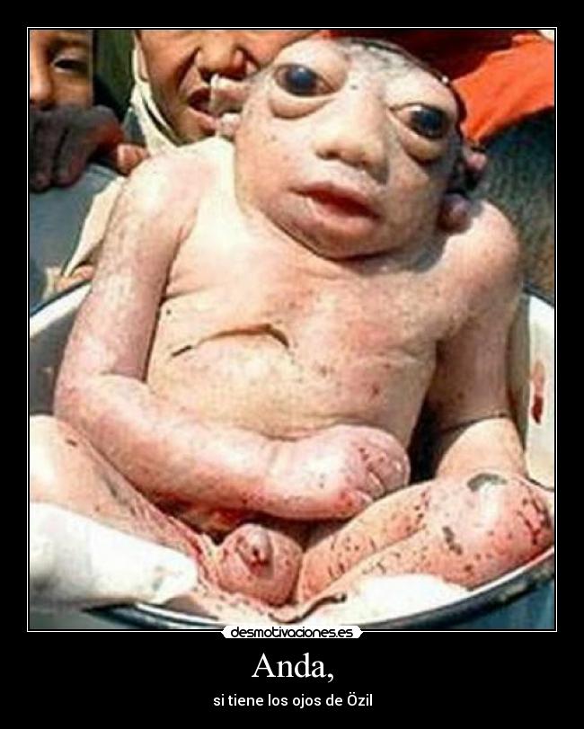 Anda, - si tiene los ojos de Özil