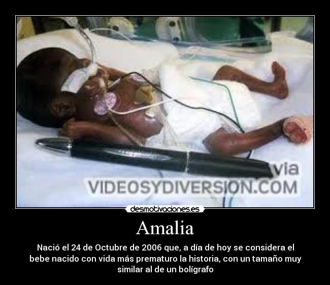 Amalia - Nació el 24 de Octubre de 2006 que, a día de hoy se considera el
bebe nacido con vida más prematuro la historia, con un tamaño muy
similar al de un bolígrafo