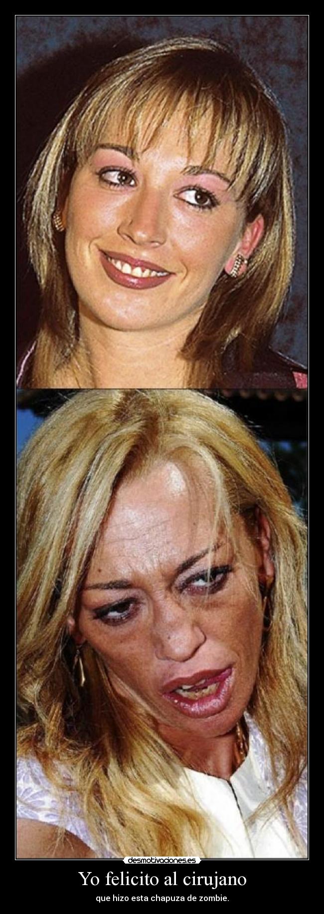 Yo felicito al cirujano - que hizo esta chapuza de zombie.