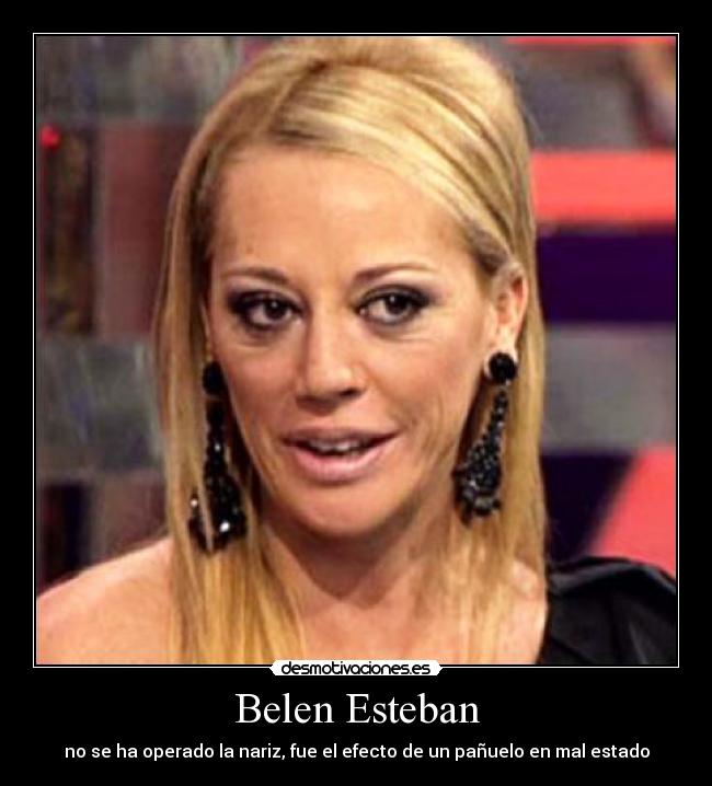 Belen Esteban - no se ha operado la nariz, fue el efecto de un pañuelo en mal estado