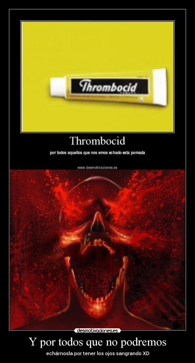 Y por todos que no podremos - echárnosla por tener los ojos sangrando XD