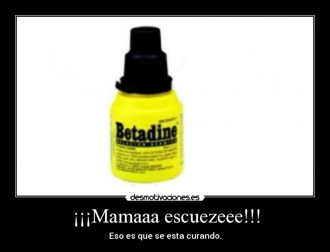¡¡¡Mamaaa escuezeee!!! -