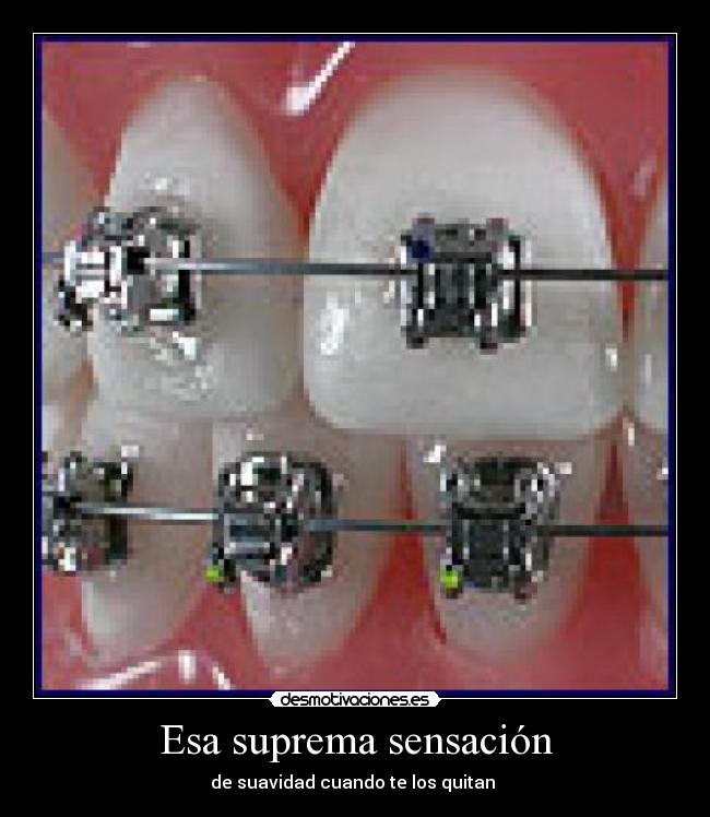 carteles dientes desmotivaciones