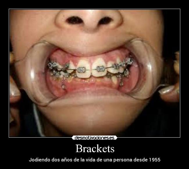 Brackets - Jodiendo dos años de la vida de una persona desde 1955