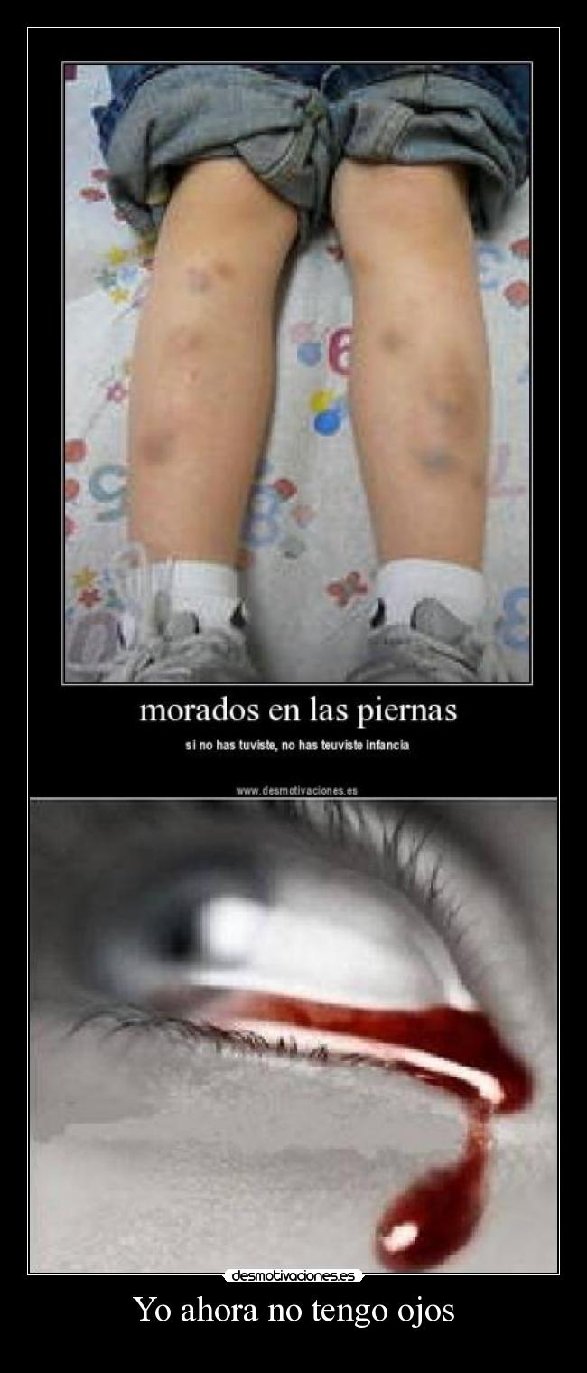 Yo ahora no tengo ojos - 