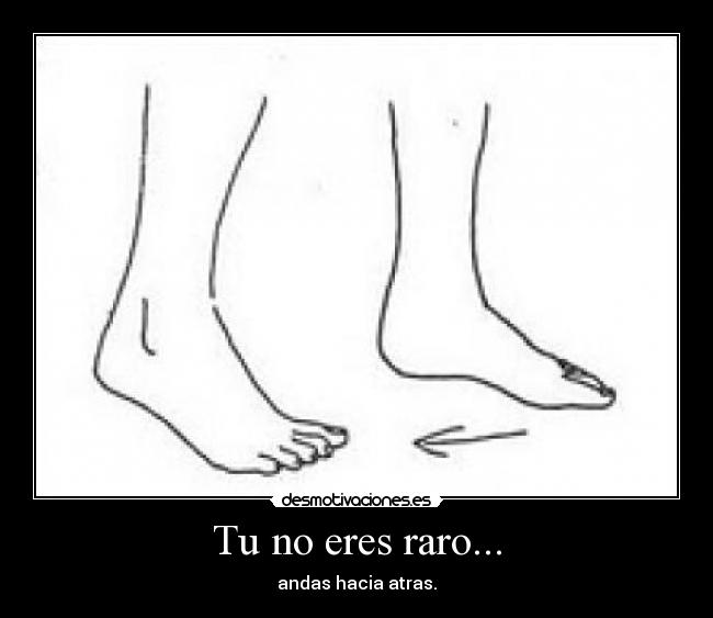 Tu no eres raro... - andas hacia atras.