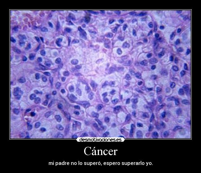 Cáncer - 