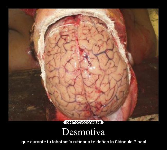 Desmotiva - 