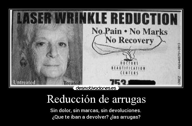 Reducción de arrugas -