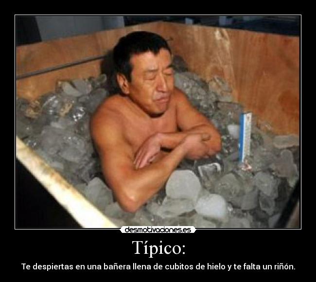 Típico: - Te despiertas en una bañera llena de cubitos de hielo y te falta un riñón.