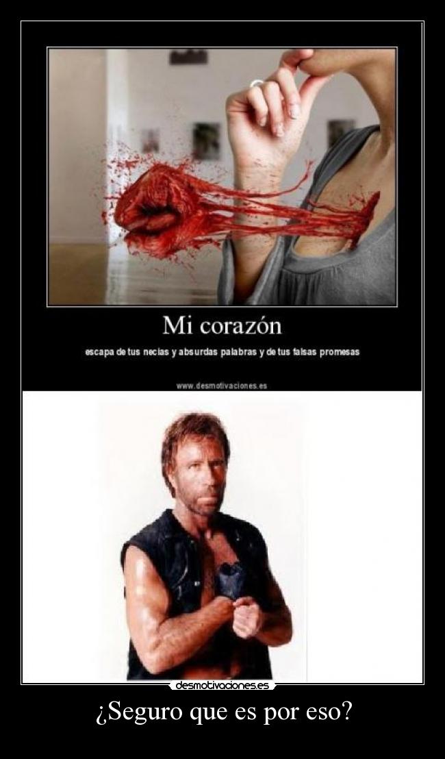 ¿Seguro que es por eso? -