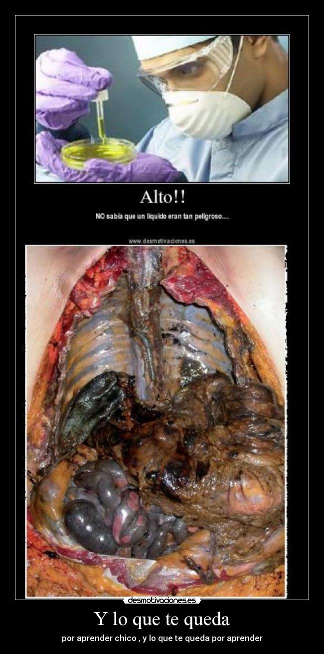 Y lo que te queda - por aprender chico , y lo que te queda por aprender