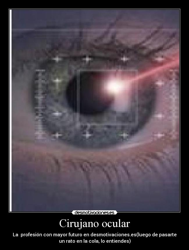 Cirujano ocular - 