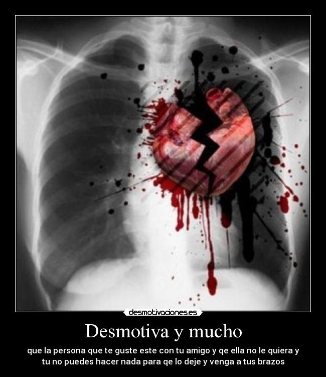 Desmotiva y mucho - que la persona que te guste este con tu amigo y qe ella no le quiera y
tu no puedes hacer nada para qe lo deje y venga a tus brazos