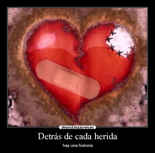 Detrás de cada herida - hay una historia