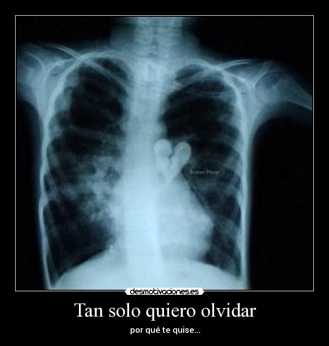Tan solo quiero olvidar -