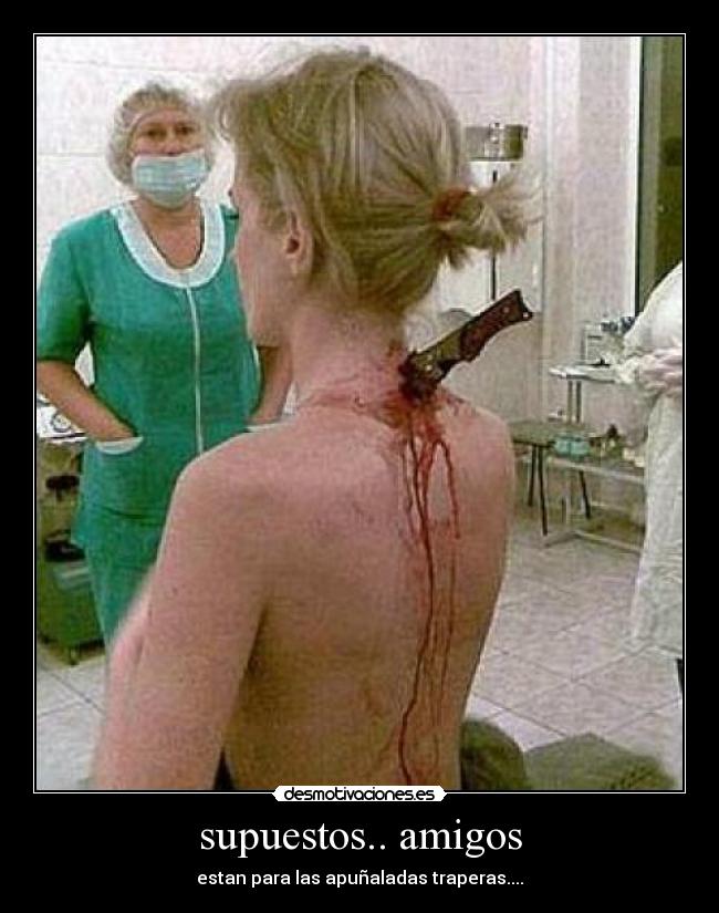 supuestos.. amigos - 