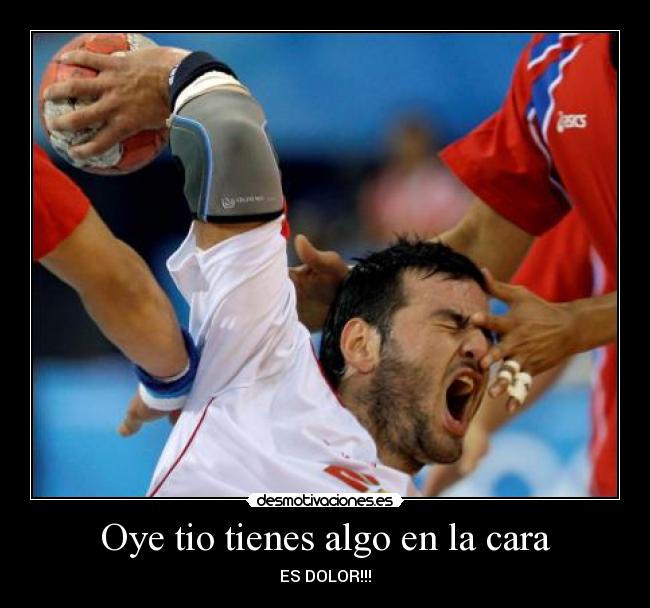 Oye tio tienes algo en la cara - ES DOLOR!!!