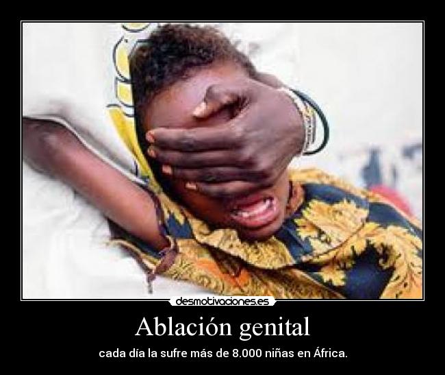Ablación genital -