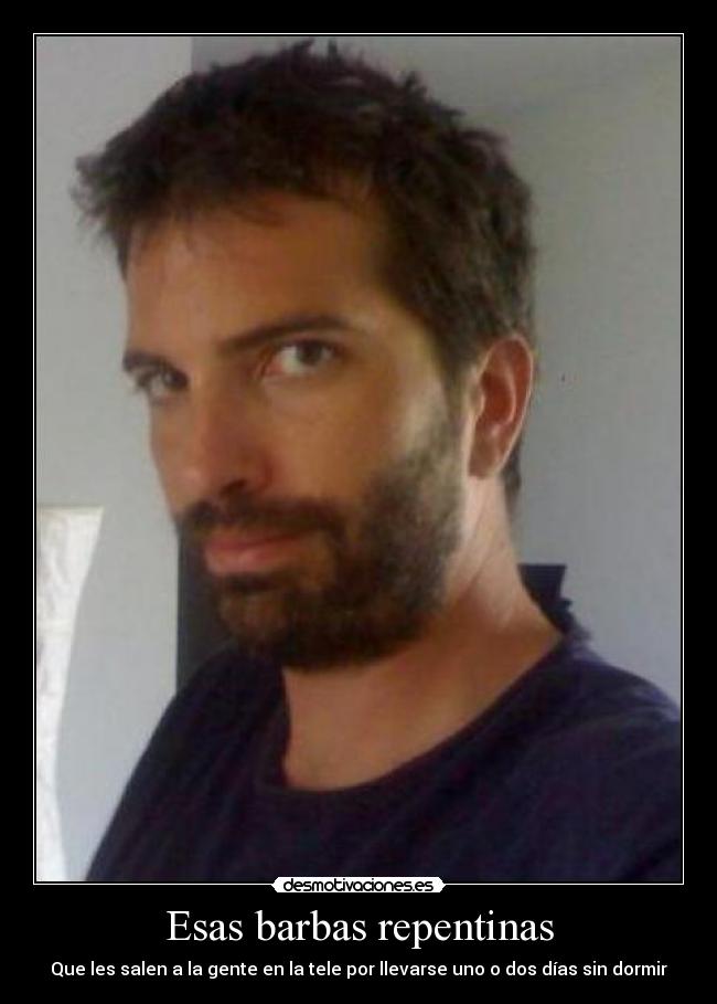 Esas barbas repentinas - 