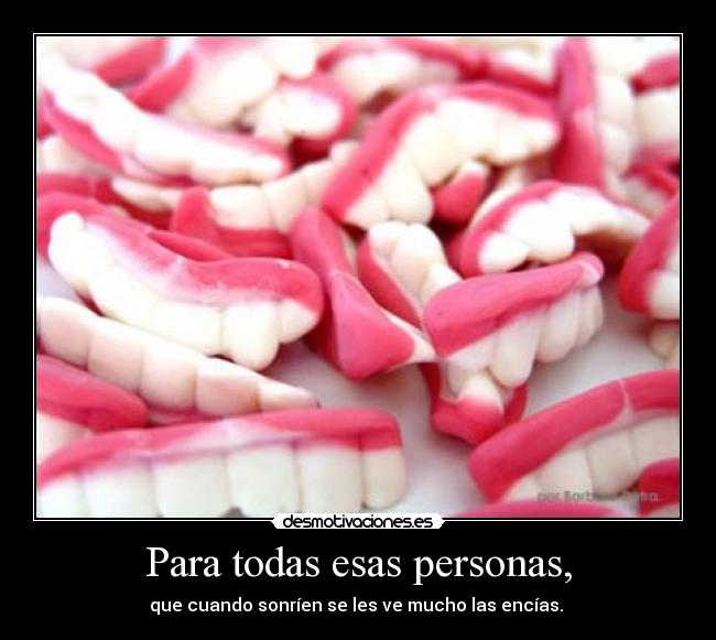 Para todas esas personas, - que cuando sonríen se les ve mucho las encías. 