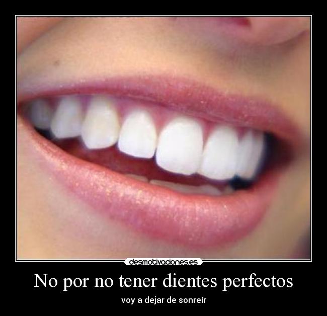 No por no tener dientes perfectos -