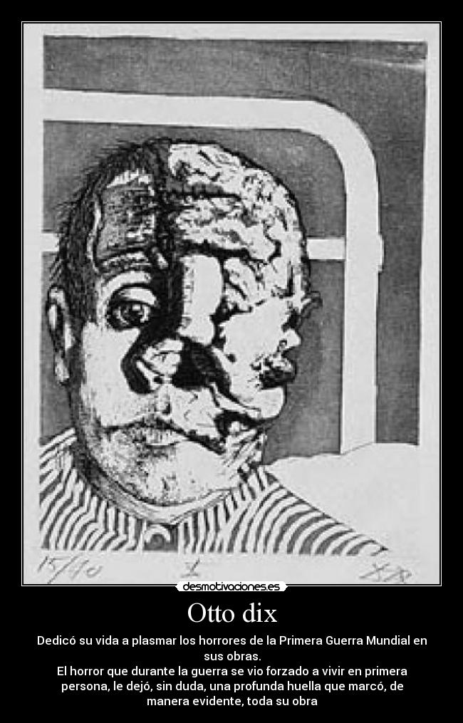 Otto dix - Dedicó su vida a plasmar los horrores de la Primera Guerra Mundial en
sus obras.
El horror que durante la guerra se vio forzado a vivir en primera
persona, le dejó, sin duda, una profunda huella que marcó, de
manera evidente, toda su obra
