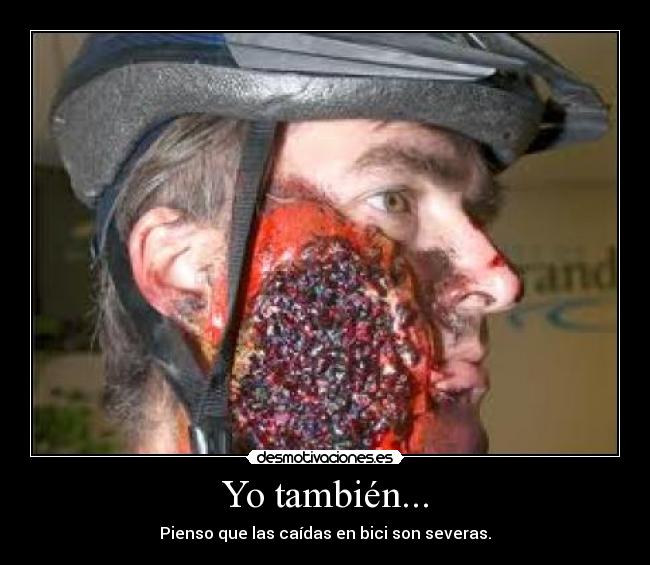 Yo también... - Pienso que las caídas en bici son severas.