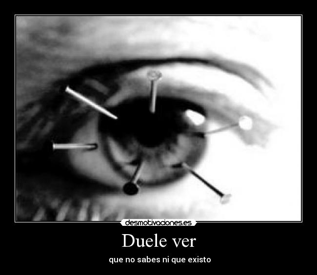 Duele ver -