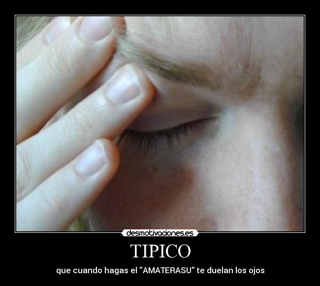 TIPICO - que cuando hagas el AMATERASU te duelan los ojos