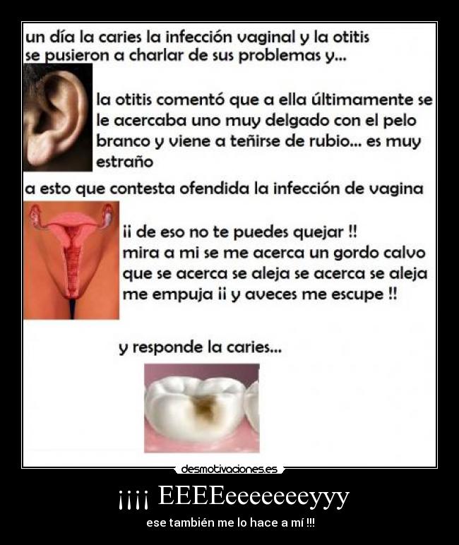  ¡¡¡¡ EEEEeeeeeeeyyy - ese también me lo hace a mí !!!