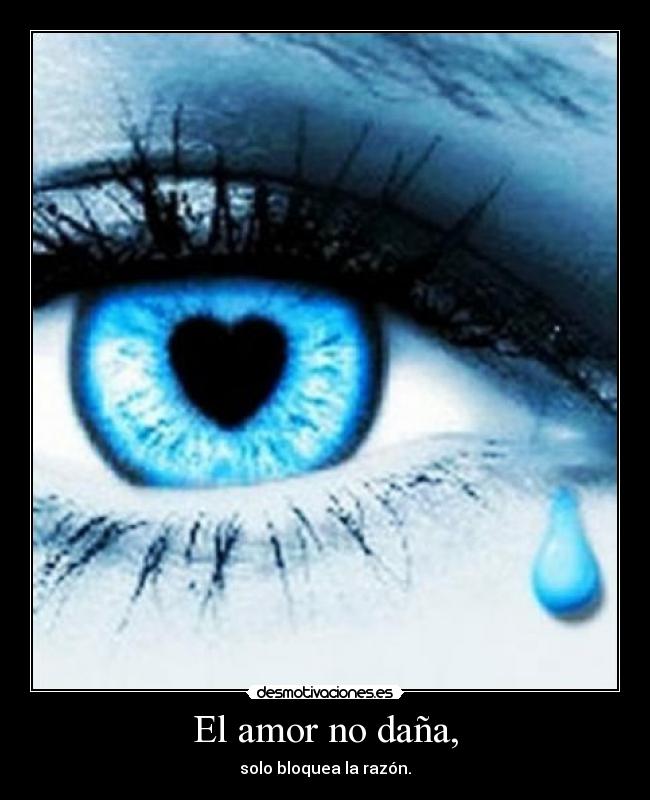El amor no daña, - solo bloquea la razón.