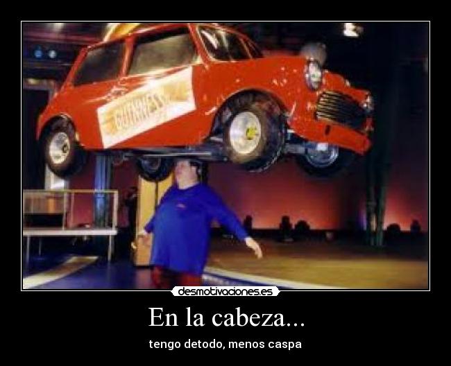 En la cabeza... - tengo detodo, menos caspa