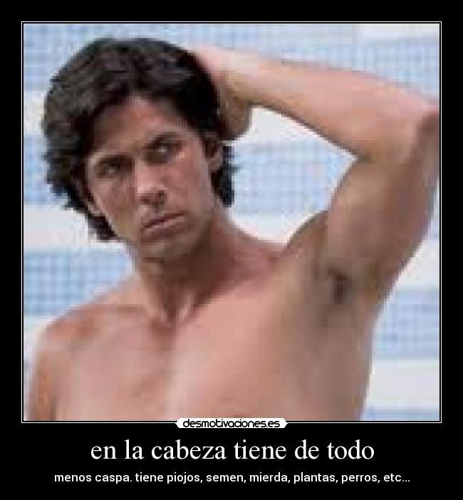 en la cabeza tiene de todo - menos caspa. tiene piojos, semen, mierda, plantas, perros, etc...