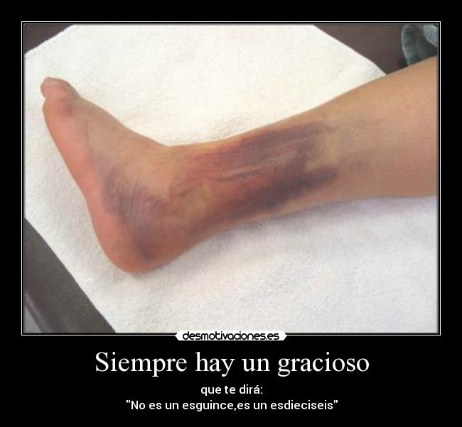 Siempre hay un gracioso -