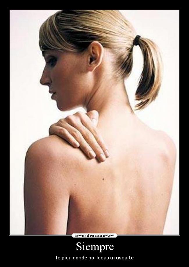 Siempre - te pica donde no llegas a rascarte