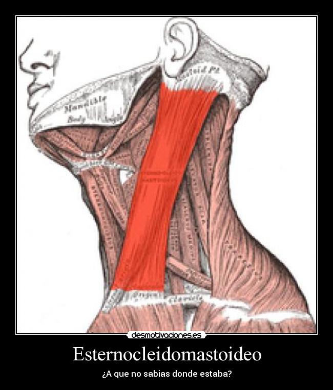 Esternocleidomastoideo -