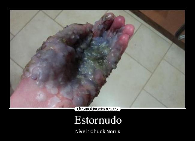 Estornudo - Nivel : Chuck Norris