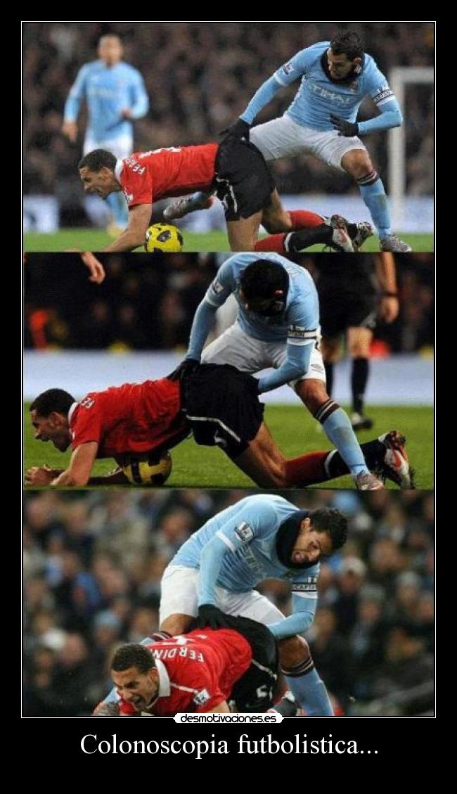 Colonoscopia futbolistica... -