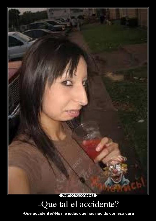 -Que tal el accidente? -