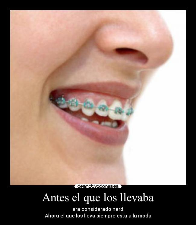 Antes el que los llevaba - era considerado nerd.
Ahora el que los lleva siempre esta a la moda