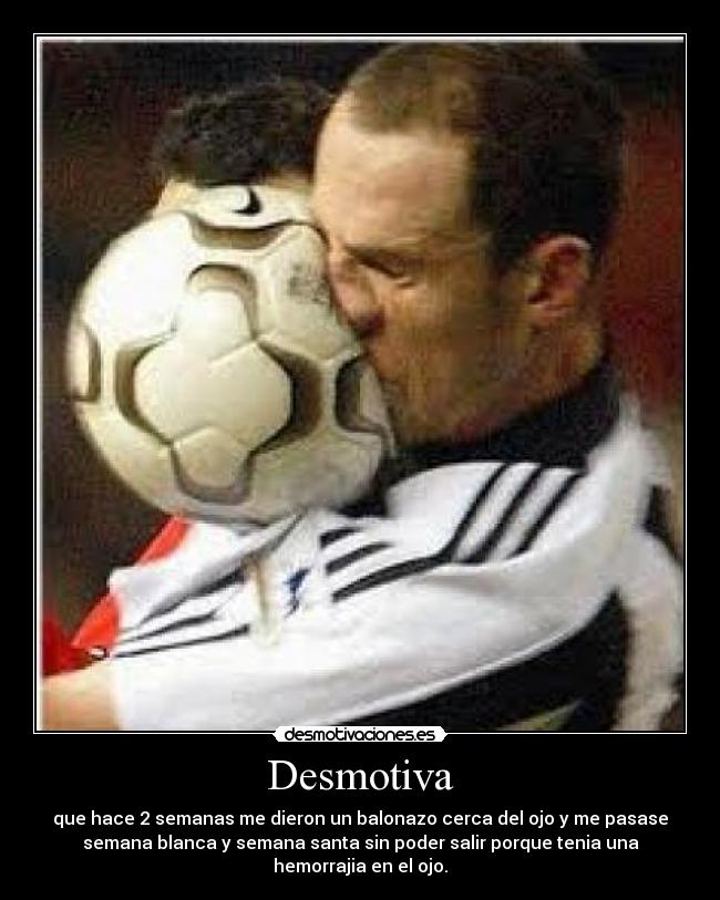 Desmotiva - que hace 2 semanas me dieron un balonazo cerca del ojo y me pasase
semana blanca y semana santa sin poder salir porque tenia una
hemorrajia en el ojo.