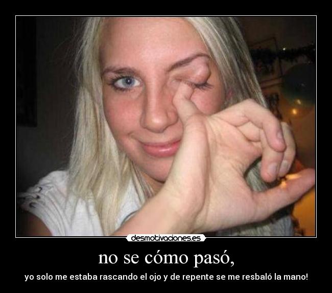 no se cómo pasó, - yo solo me estaba rascando el ojo y de repente se me resbaló la mano!