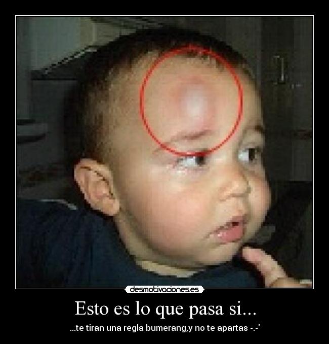Esto es lo que pasa si... - ...te tiran una regla bumerang,y no te apartas -.-