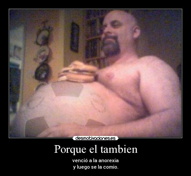 Porque el tambien - venció a la anorexia
y luego se la comio.