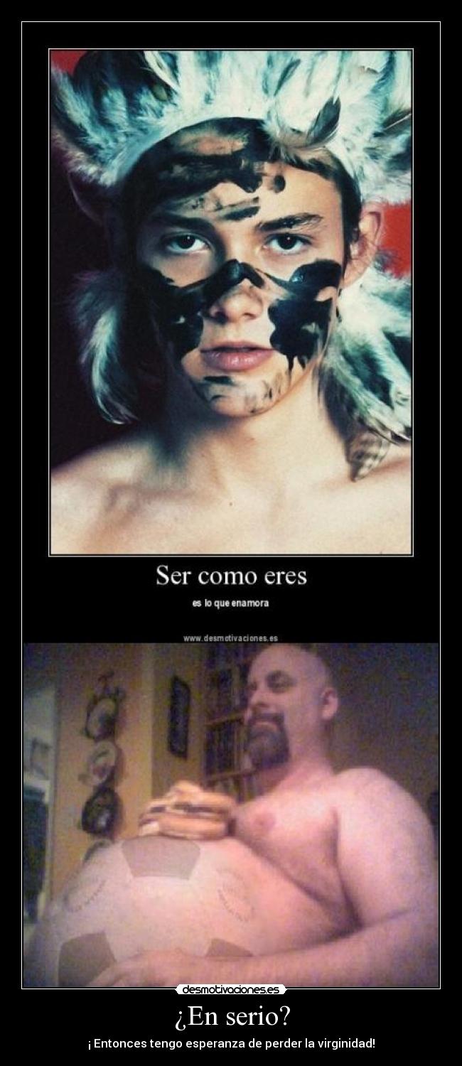 ¿En serio? - 