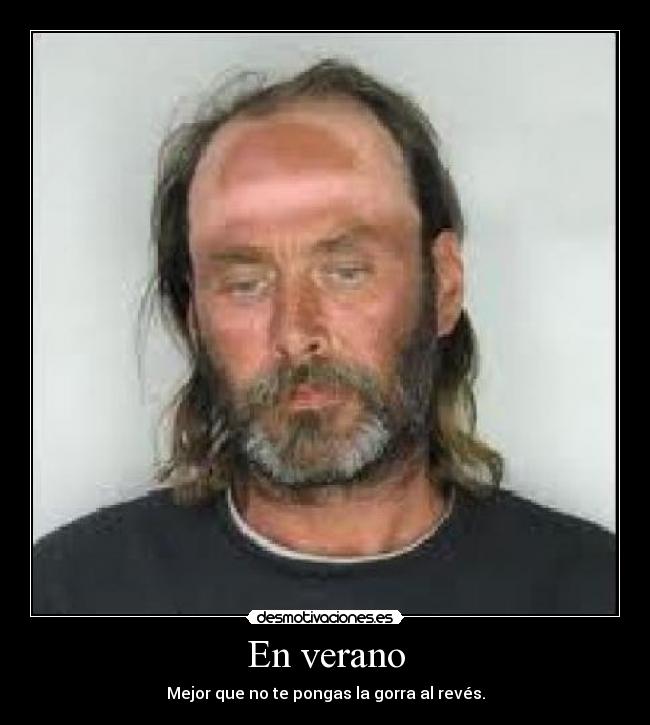 En verano - Mejor que no te pongas la gorra al revés.